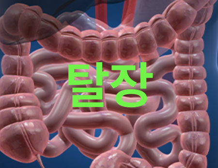 탈장