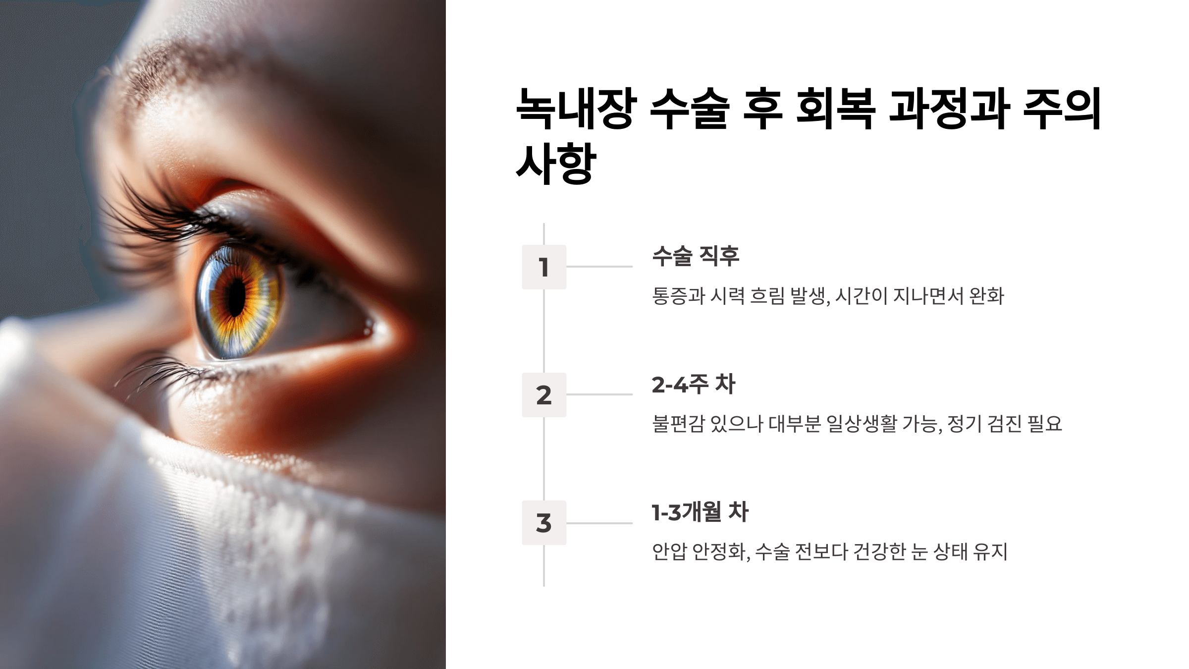 녹내장과 관련된 사진입니다.