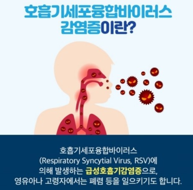 RSV-호흡기-세포융합-바이러스-증상