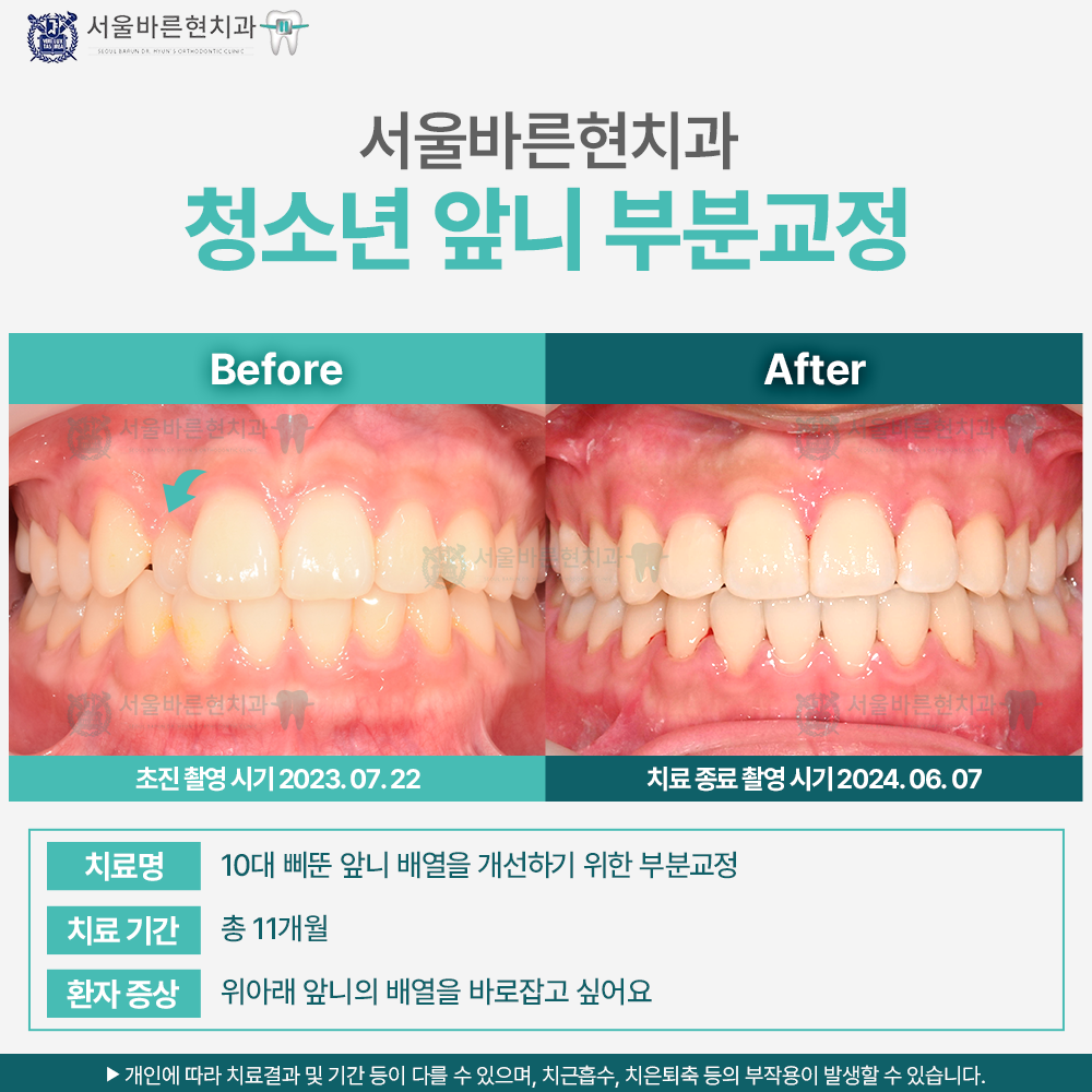 부산청소년교정