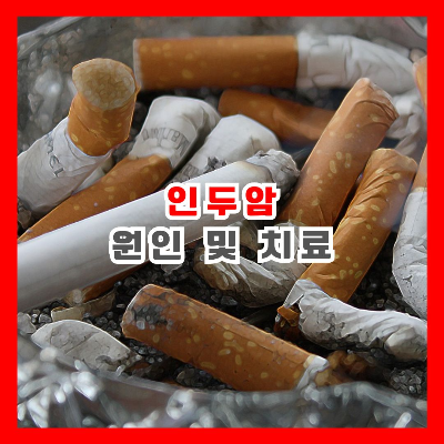 담배꽁초