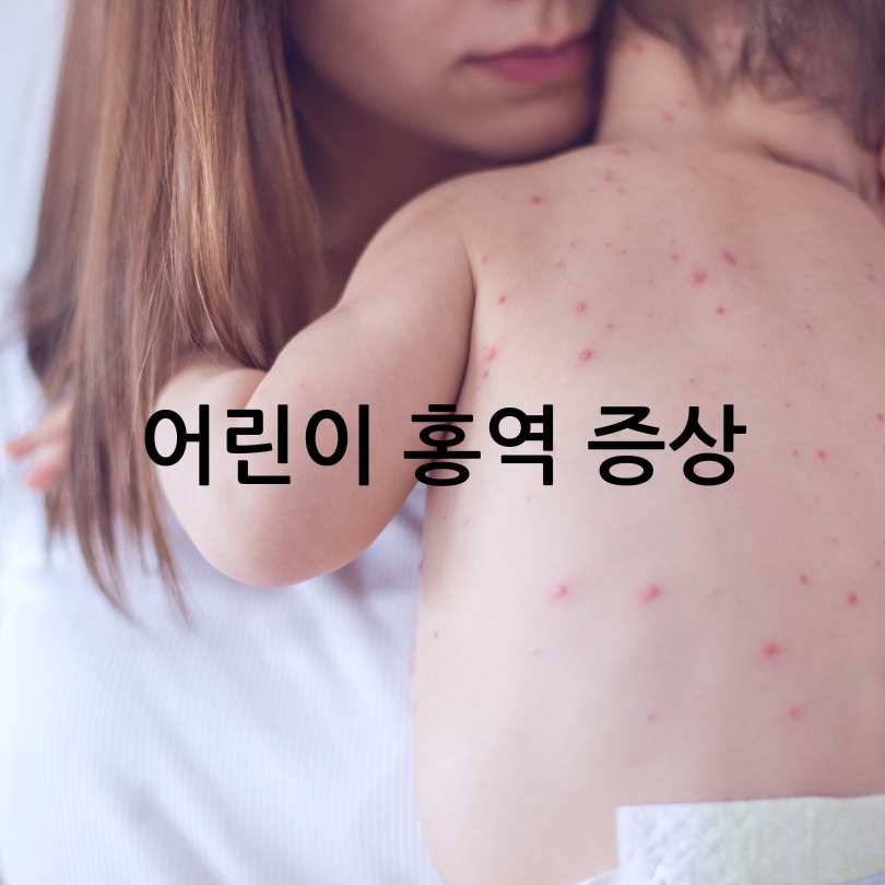 성인 홍역과 어린이 홍역의 차이점