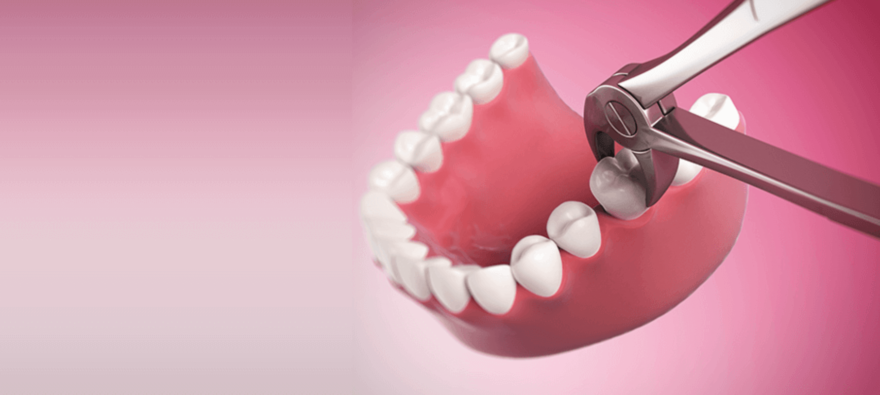 사랑니 발치후 음식