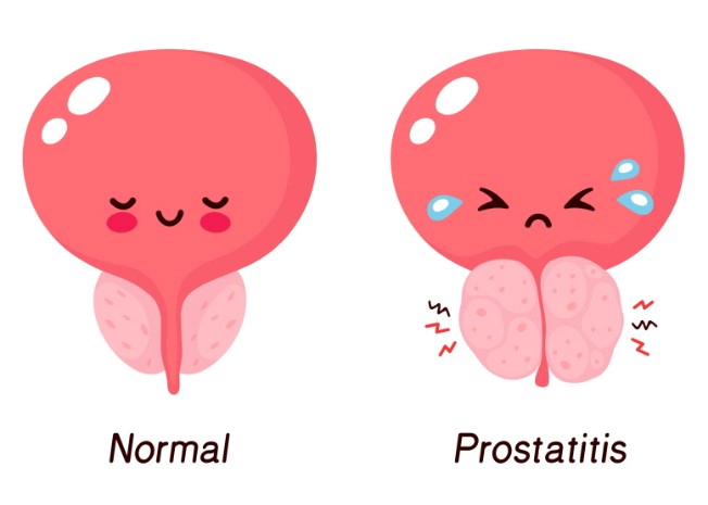 전립선 비대증 증상 발기부전 및 전립선 비대증에 좋은 마사지