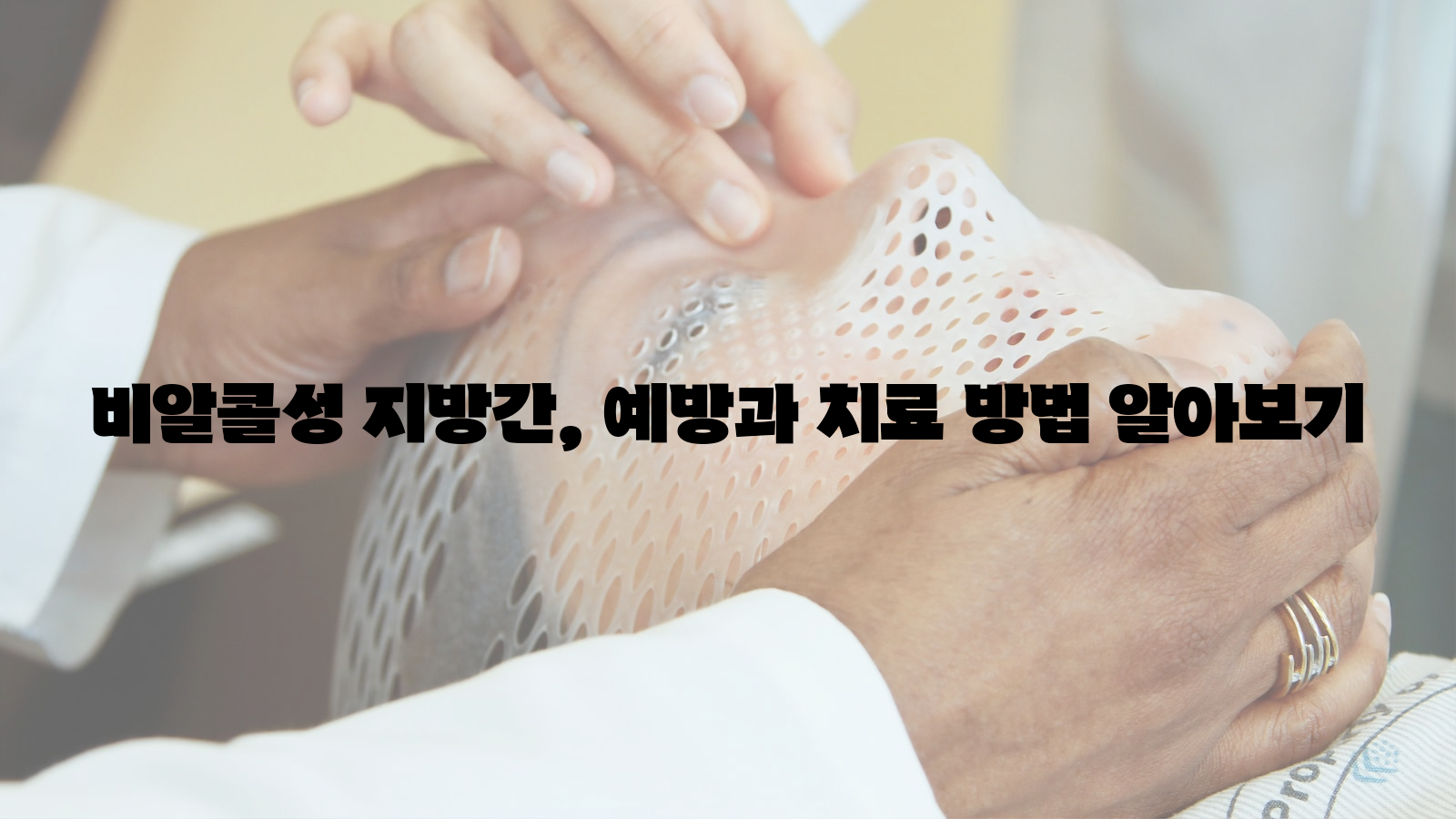 비알콜성 지방간, 예방, 치료 방법