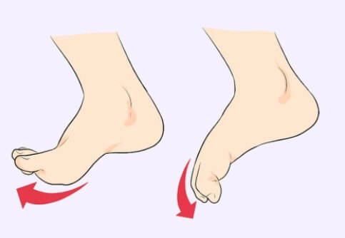 족저근막염 치료 중