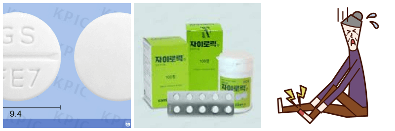 자이로릭정, 통풍 사진
