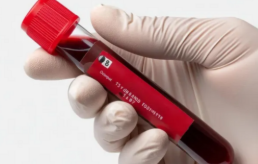 당화혈색소-사진4