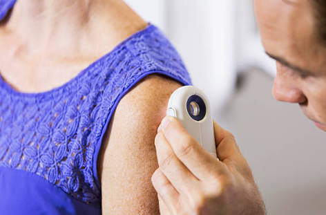 쥐젖 제거방법, 쥐젖이 생기는 이유, 제거 연고 총정리 (2024ver)