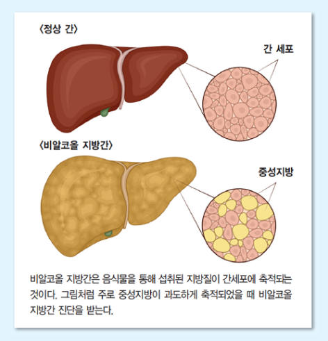 간(1)