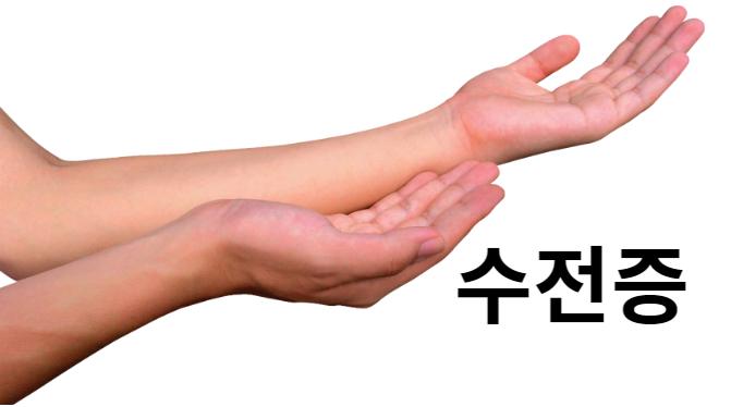 수전증