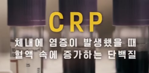 cpr