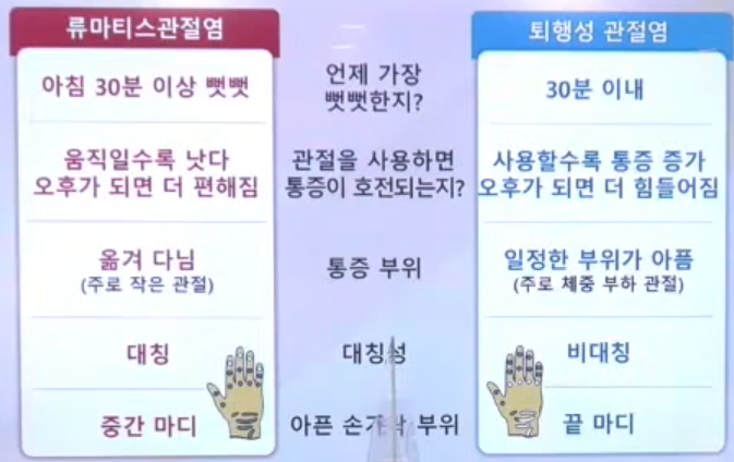 류마티스 관절염과 퇴행성 관절염 비교