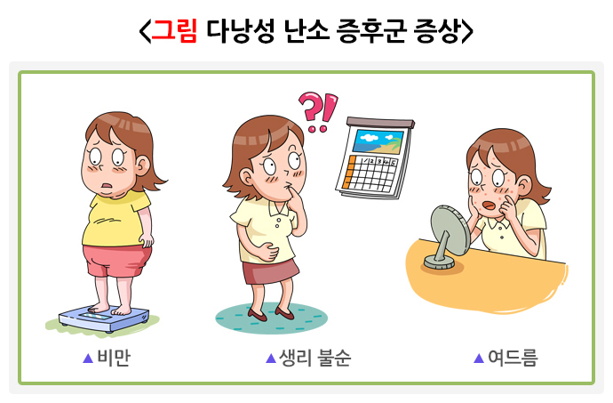 다낭성_난소_증후군_증상