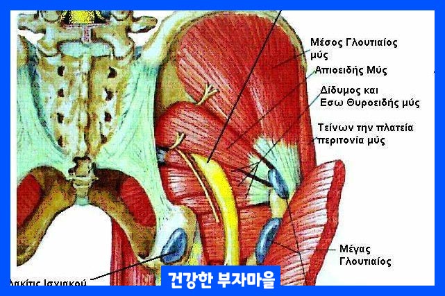 염증을 줄이기 위한 코르티코스테로이드 주사로 치료