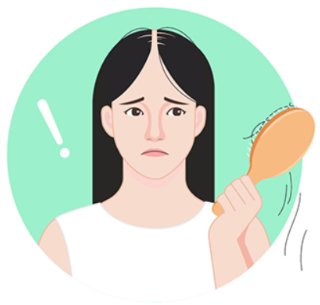 빗에 머리가 많이 빠진 여성형 탈모를 겪고 있는 여성