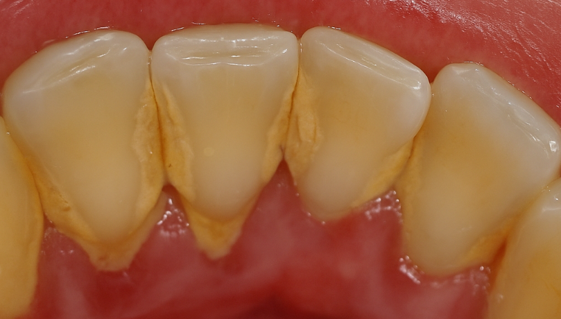 스케일링 가격 비용