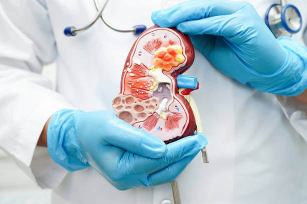 신우신염 초기증상? 무시하면 위험한 신호!