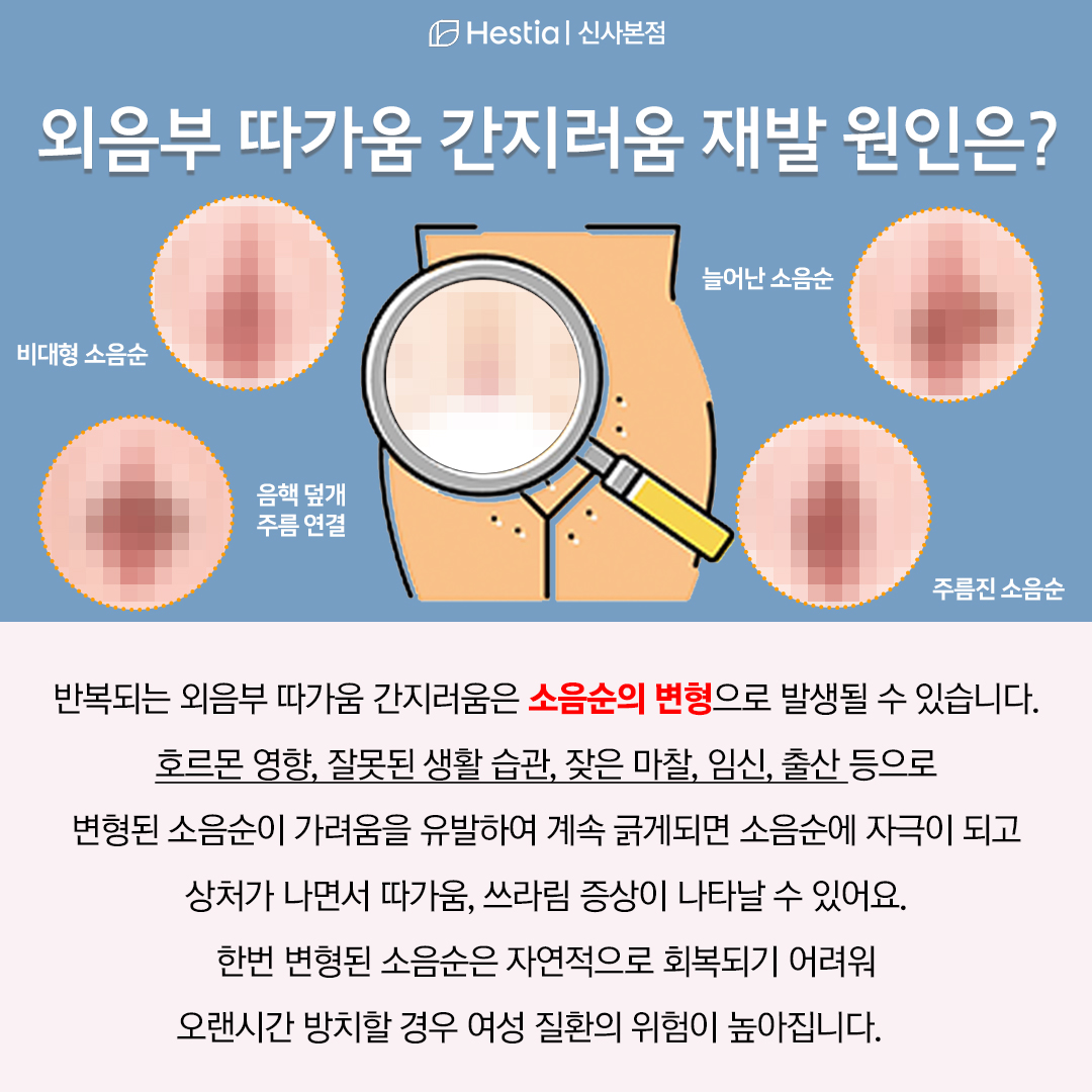 외음부 간지러움 따가움 재꾸 재발하는 이유는?