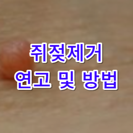 쥐젖-제거방법