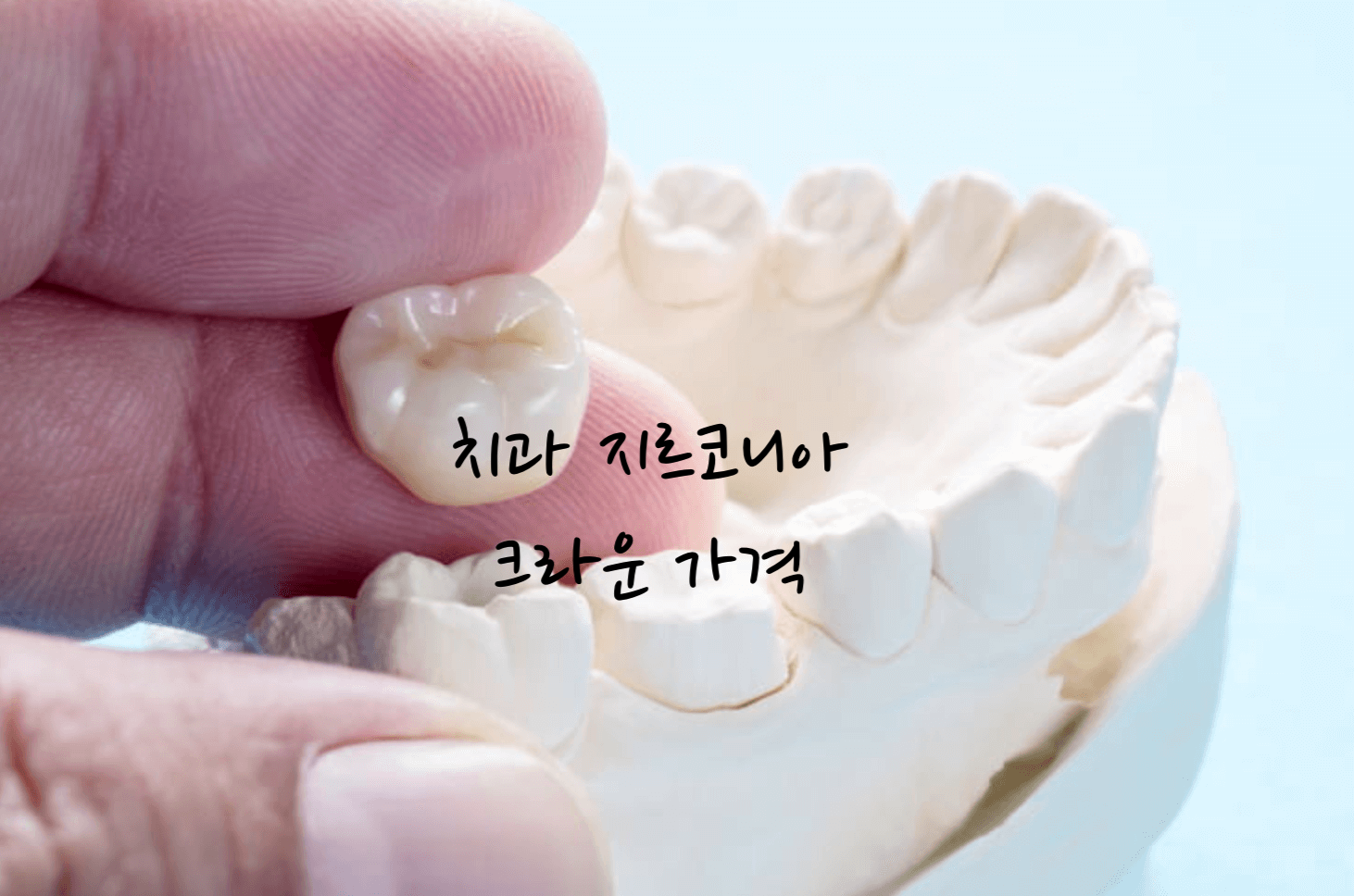 지르코니아 크라운