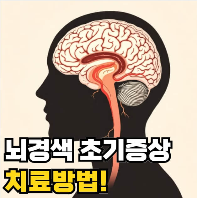 뇌경색 초기증상 치료방법