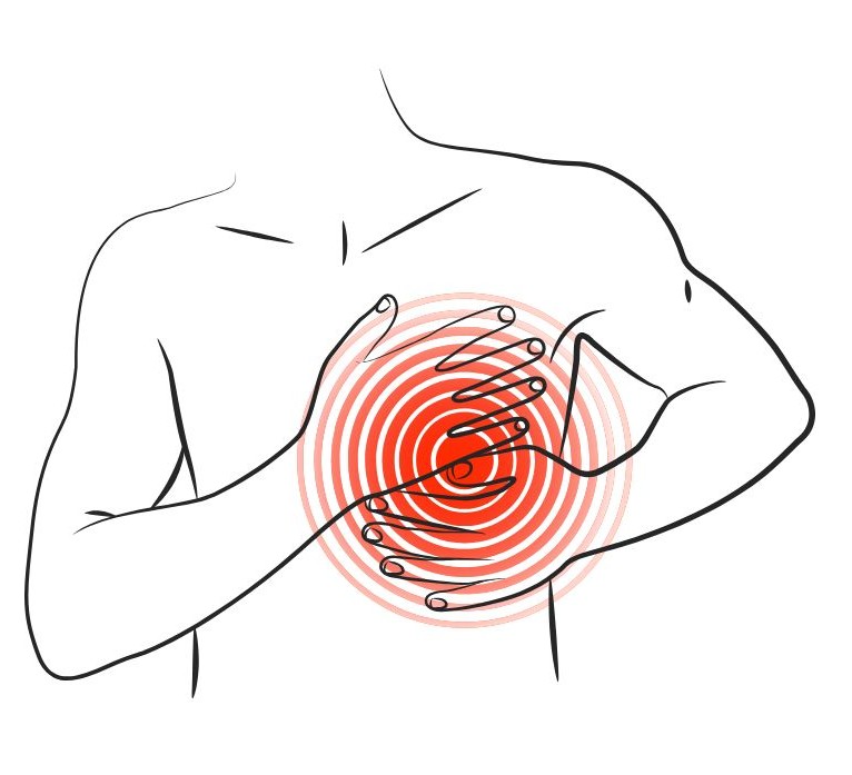 가슴 통증 이미지