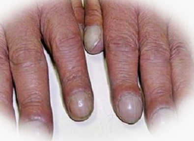 간이 죽어가는 12가지 신호와 대책