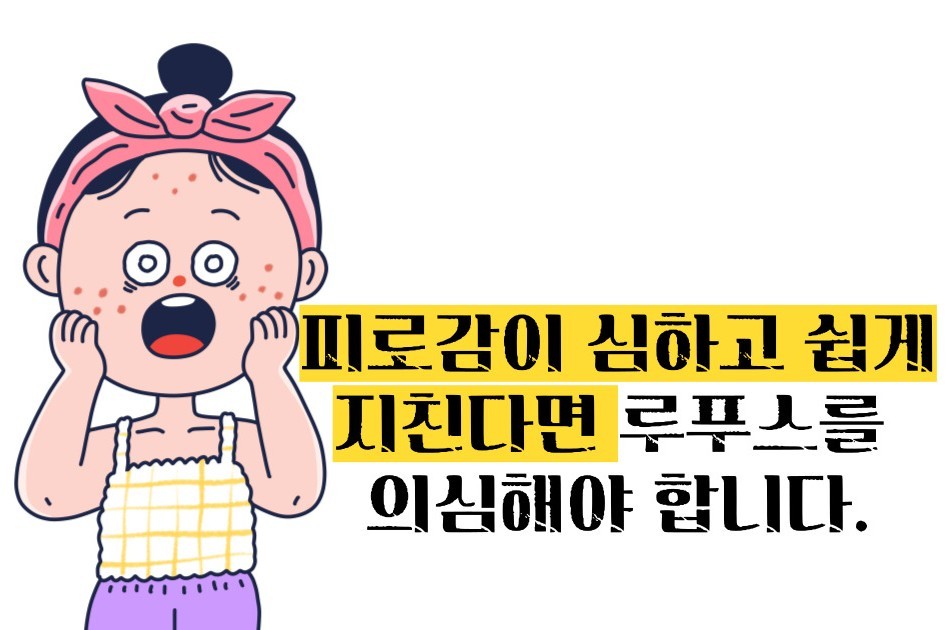 루푸스병 이란
