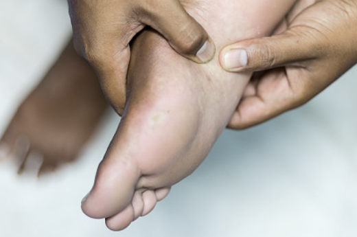 발바닥통증의 원인 25