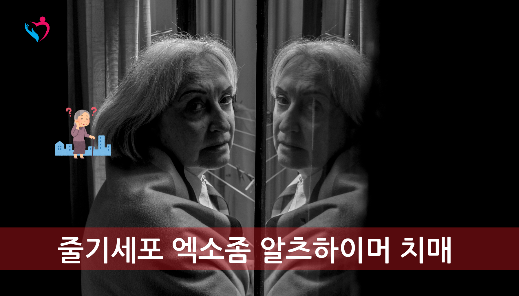 알츠하이머 치매 개선 가능한 방법이 있는가