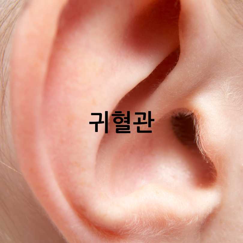 귀주름과치매와뇌졸중