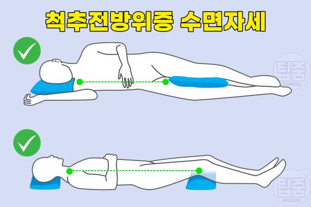 허리에 좋은 수면자세 나쁜자세 척추전방전위증