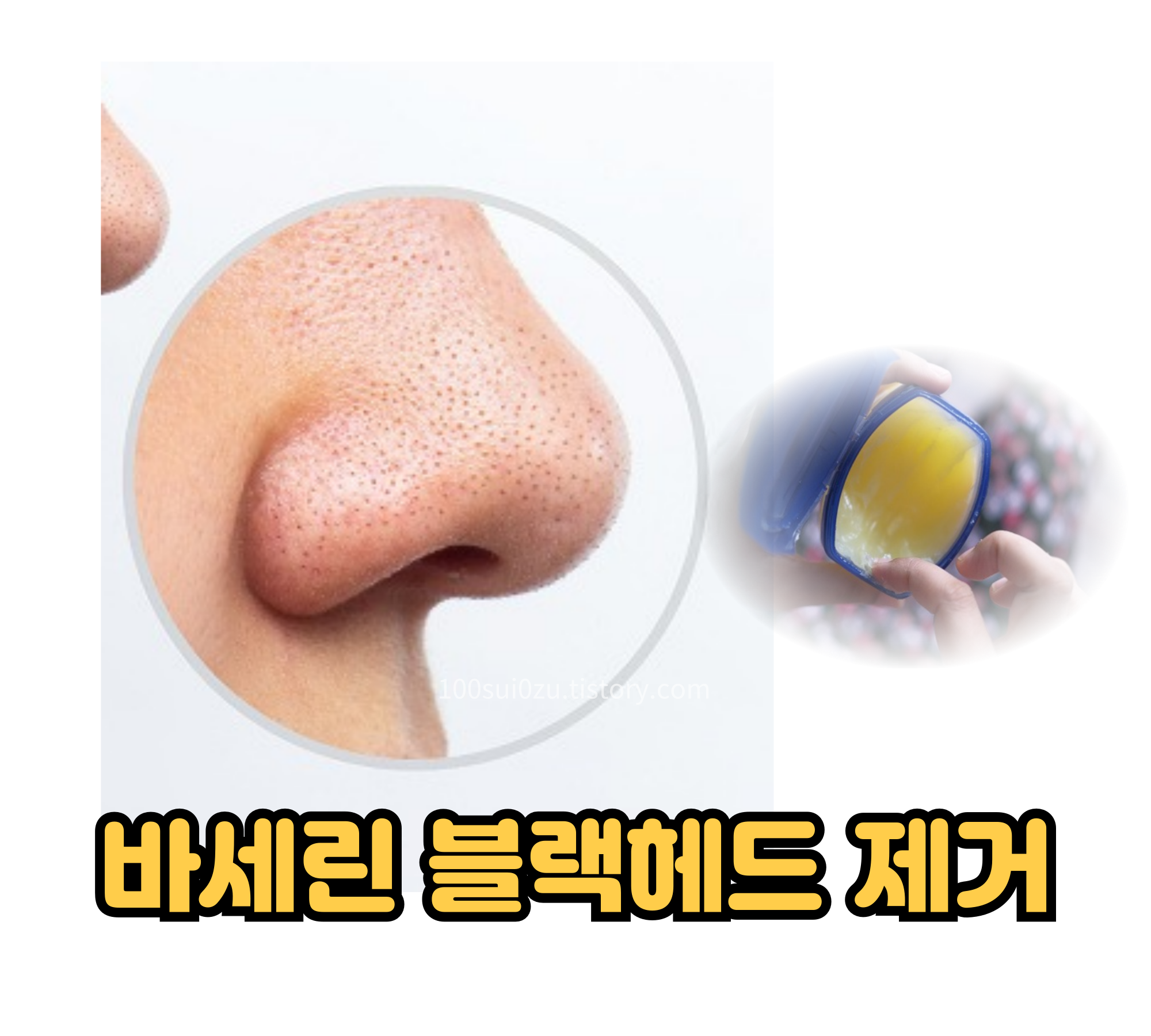 바세린-블랙헤드-제거.jpg