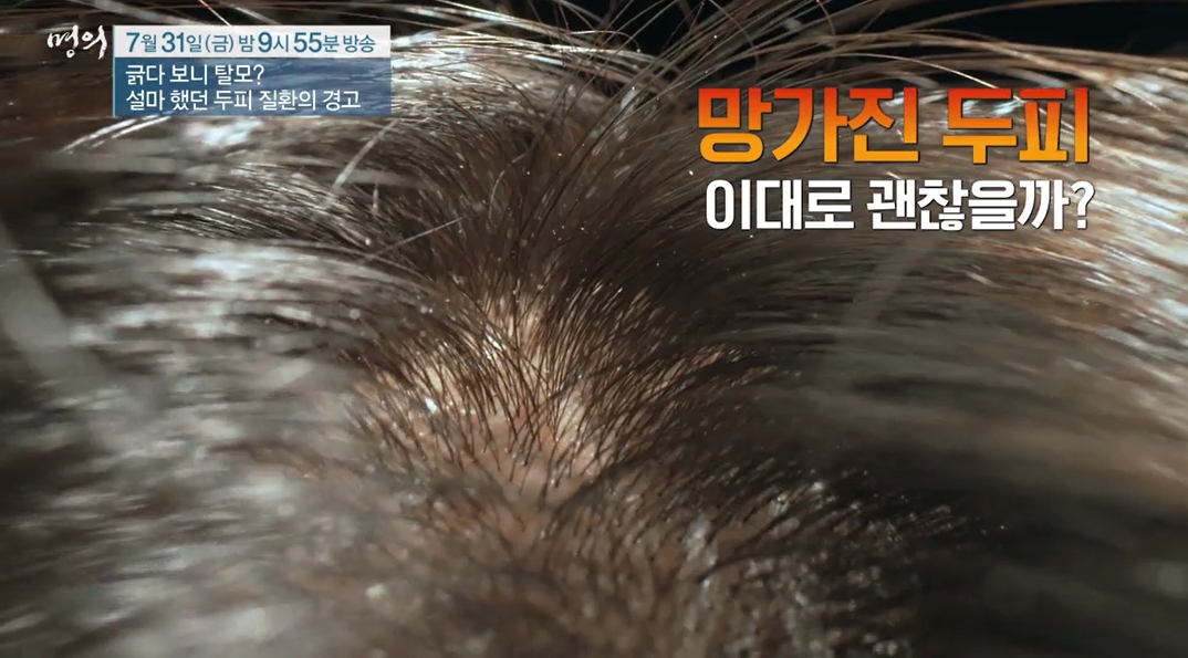 명의 두피질환