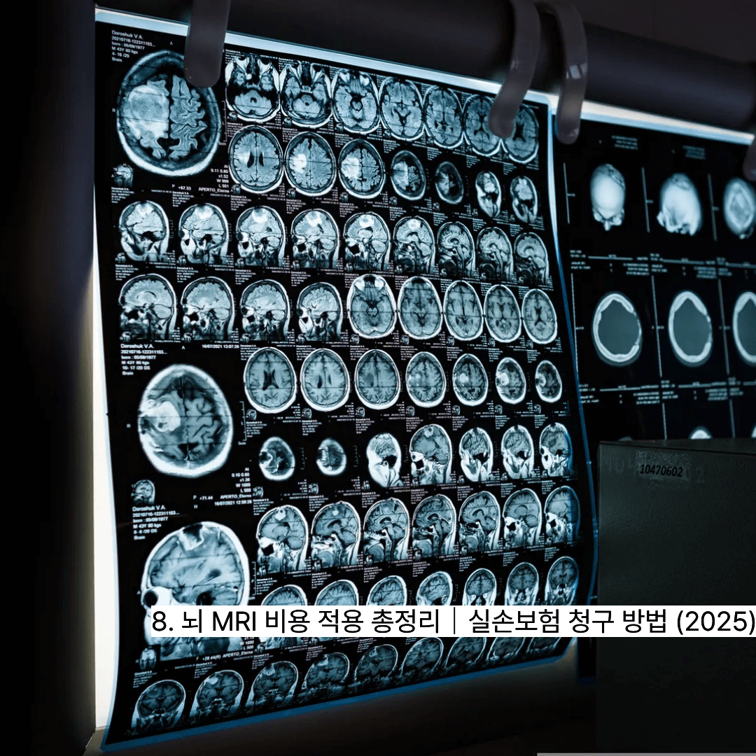 8. 뇌 MRI 비용 적용 총정리|실손보험 청구 방법 (2025)