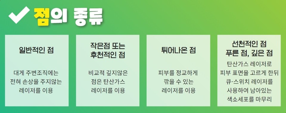 점의 종류