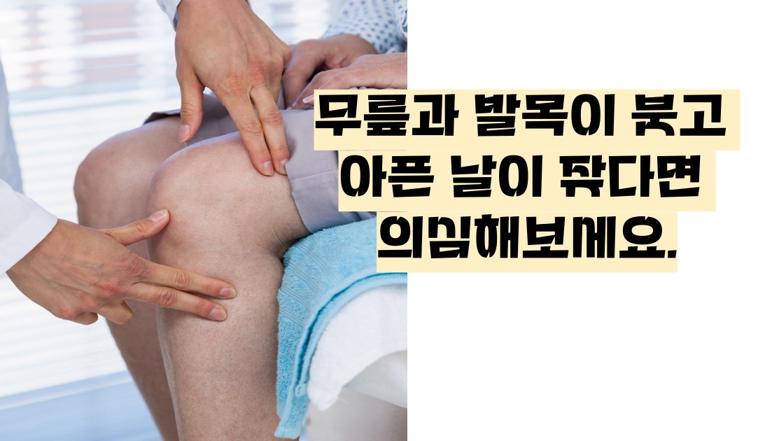 류마티스 관절염 초기증상