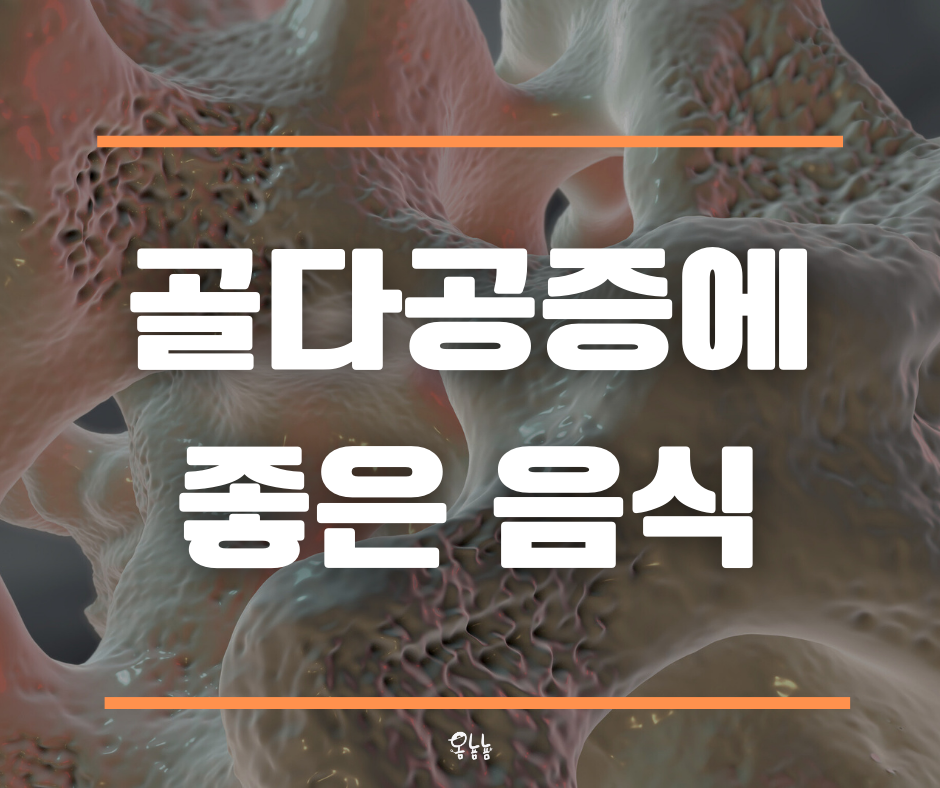 골다공증에 좋은 음식