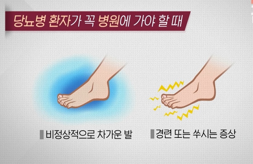 -천동일-교수-당뇨병증상