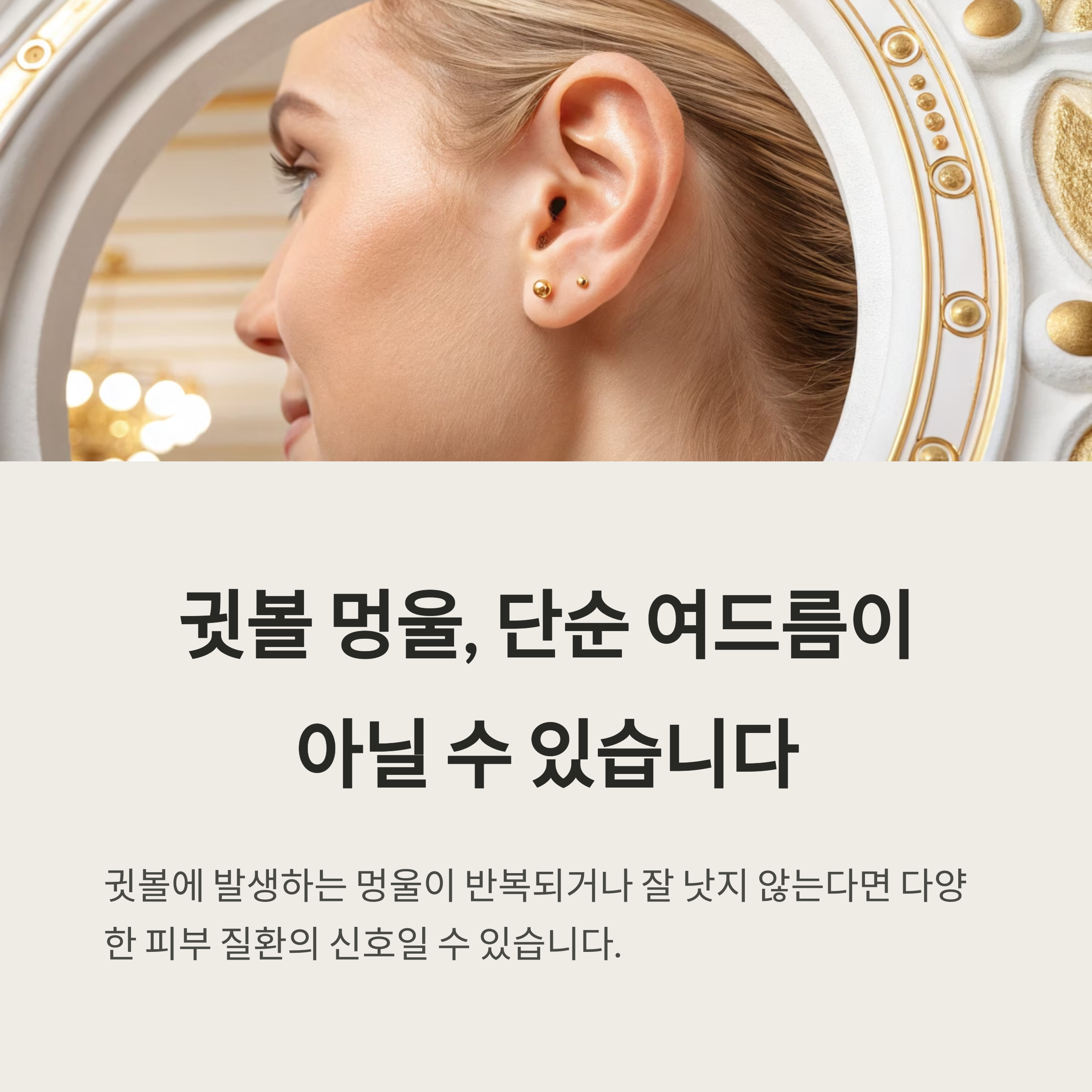 귓볼 멍울