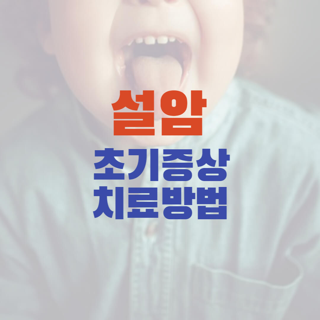 설암초기증상
설암치료방법