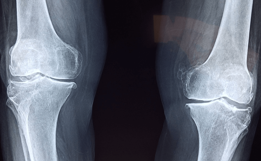 꼬막 효능은 뼈 건강에도 많은 도움을 준다