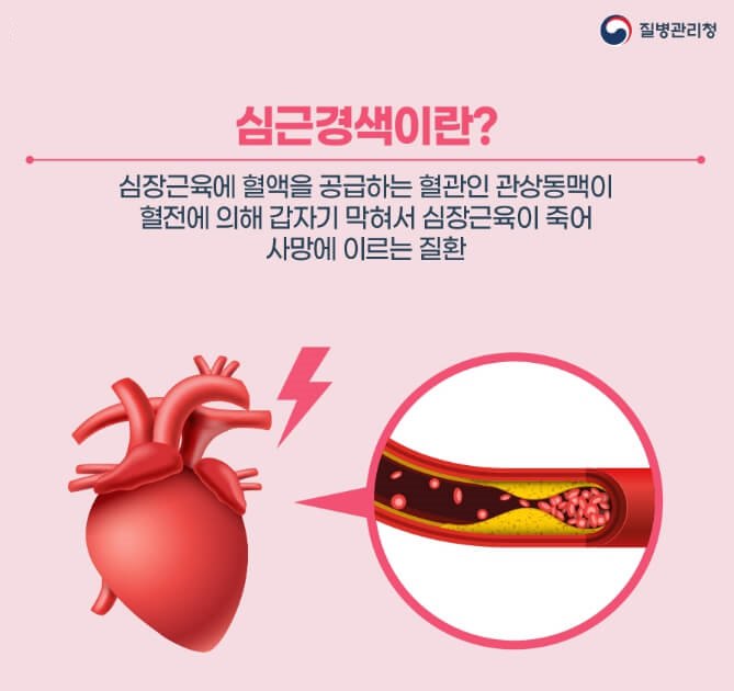 심근경색이란