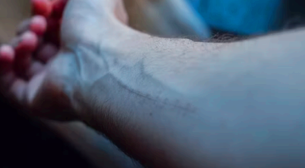 손목 통증 원인 