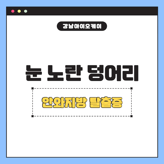 눈-노란-덩이러-안와지방