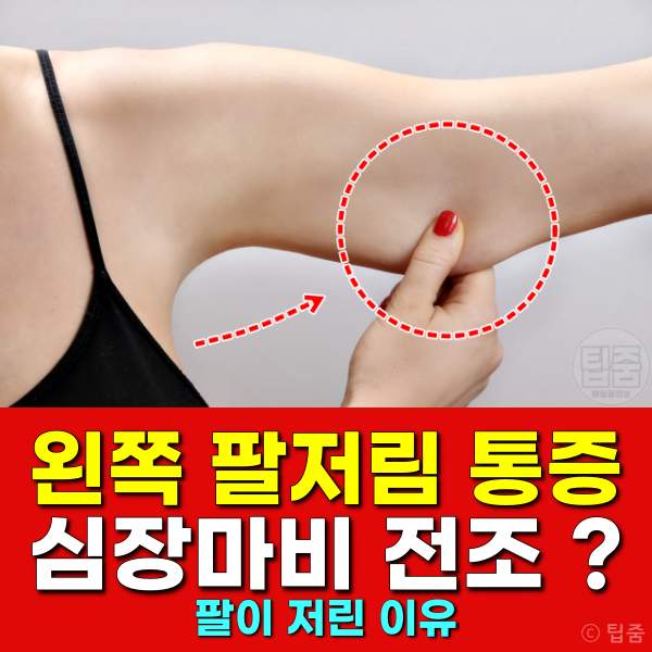 왼쪽 팔저림 심장마비 전조증상,팔이 저린 이유