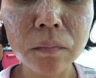 도미나크림 가격 정보 및 실제 사용후기와 효과 성분 정리_13