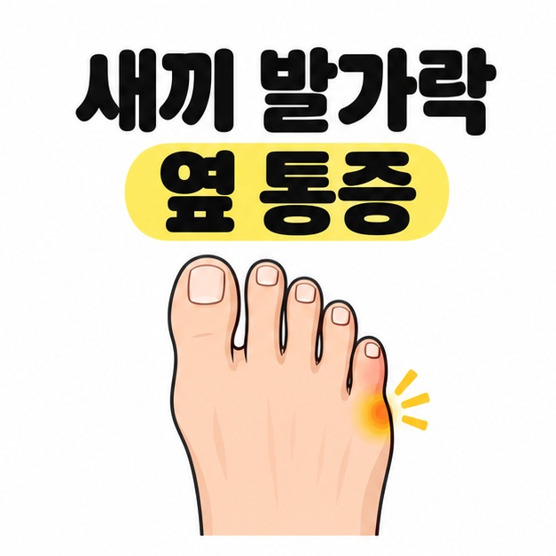 새끼발가락 옆 통증이라는 제목 아래 발등에서 본 발의 새끼발가락 뿌리 바깥쪽을 노란색으로 표시한 그림