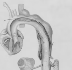 신장이 안좋으면 나타나는 증상